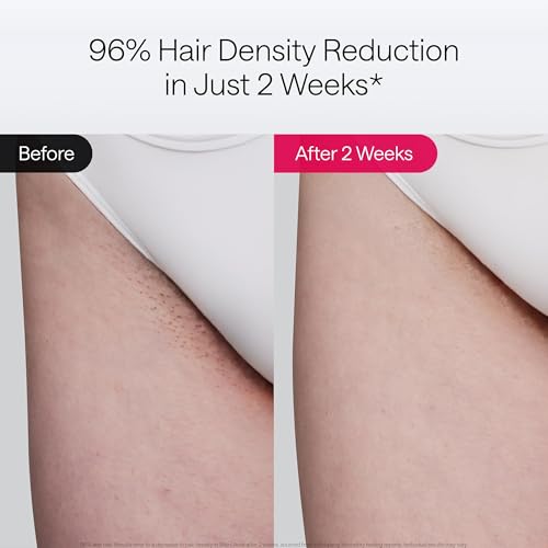 Laser Hair Removal Device with Ice Cool, Dual Lights, Skin Sensor & USHR Mode X435274